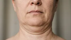 5 Übungen, die helfen, ein Doppelkinn loszuwerden